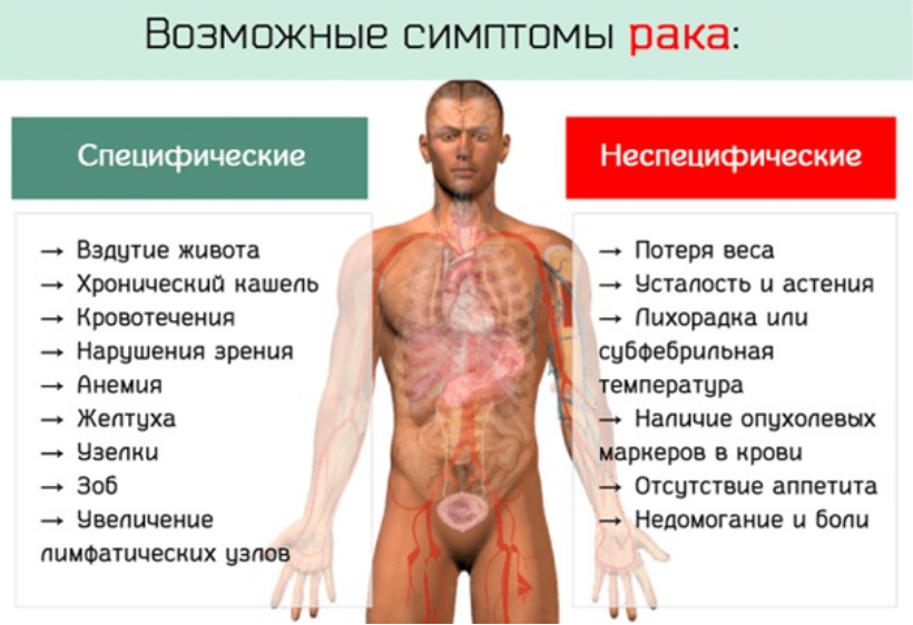 Симптомы раковых заболеваний человека. Симптомы онкологических заболеваний. Симптомы при онкологии.