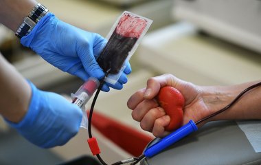 Названо неочевидний спосіб виявити рак крові на ранній стадії
