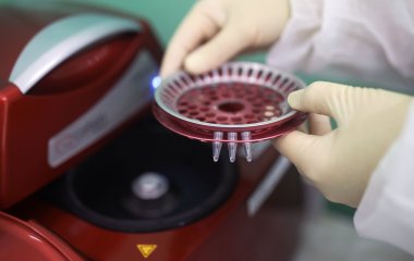 Вчені назвали головну загадку спалаху віспи мавп
