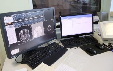 Лікар розповіла про нетиповий симптом пухлини головного мозку