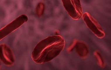 Лікарі розповіли які продукти провокують закупорку судин та розвиток тромбозу.