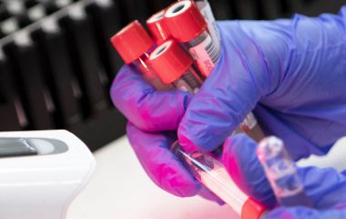 Вірусолог попередив про появу більш інфекційних штамів COVID-19