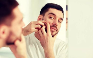 Розкрито механізм утворення вугрового висипу