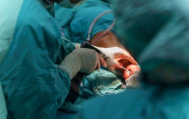 Вчені попередили про ризик некрозу кісток після тяжкого перебігу COVID-19