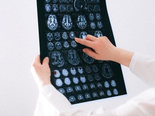 Цей сигнал у крові може передвіщати проблеми з пам’яттю