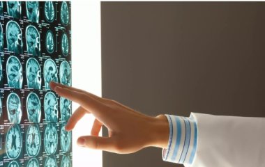 Медики виявили в організмі людини невідомий науці орган