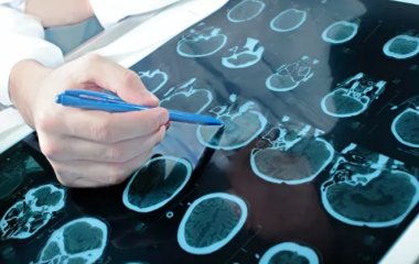 Онколог заявив про важливість обстежень на рак