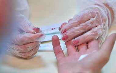 Врачи назвали признаки повышенного холестерина: важно знать каждому