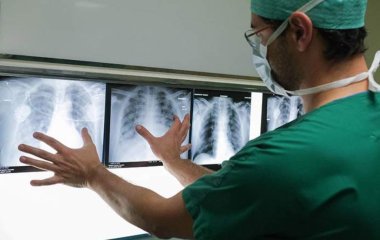 Вчені заявили про вплив глобальної зміни клімату на здоров'я людей