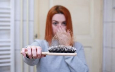 Лікар розповів про причини облисіння при COVID-19