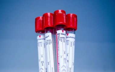Эксперты рассказали, в чем уникальность людей со второй группой крови