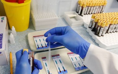 Вчені знайшли найбільш ефективне лікування немовлят із ВІЛ