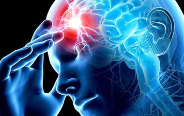 Чтобы не настиг инсульт: медики рассказали, как предотвратить развитие опасного заболевания