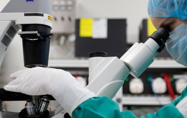 Синдром Дауна звинуватили у прискореному старінні нейронів мозку