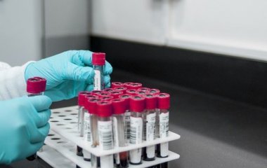 Вчені виявили зв'язок між небезпечними захворюваннями та групою крові