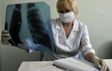 Лікарі пояснили причину розвитку крихкості кісток після COVID-19