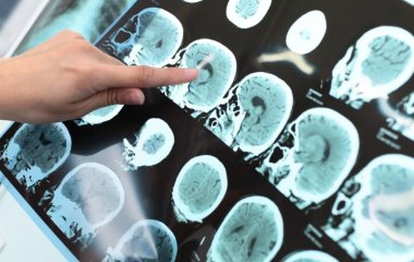 Вчені виявили ще одну небезпеку алкоголю