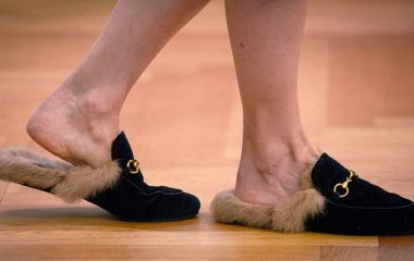 Лікарі назвали способи боротьби з набряками ніг у спеку