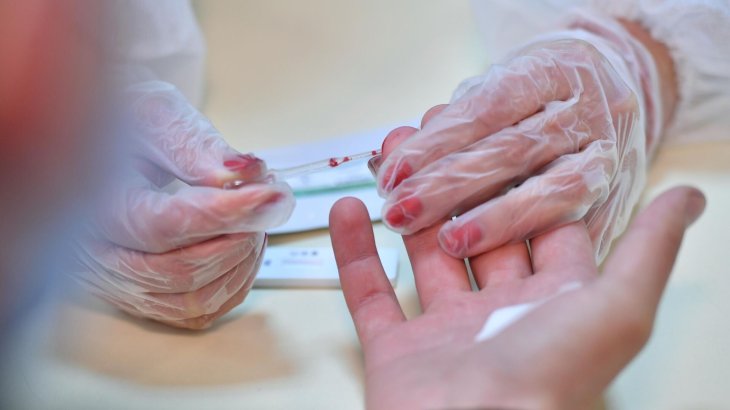 Як визначити рівень холестерину: зверніть увагу на шкіру