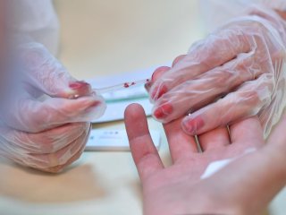 Как определить уровень холестерина: обратите внимание на кожу