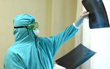 Радіолог розповів, у яких випадках радіація може принести користь