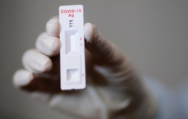 Антитіла: чим різняться, скільки живуть? І ще 13 питань щодо них