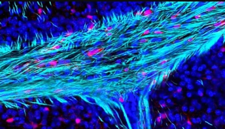 Открыт главный фактор старения мозга