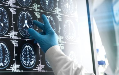 Не лише втрата пам’яті: експерти назвати три приховані ознаки деменції, які часто ігнорують