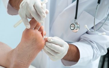 Определяем опасность! Симптомы грибка ногтей. Советы врачей
