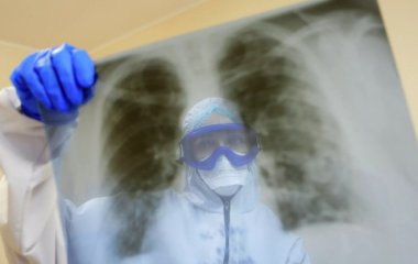 Вчені з'ясували, як COVID потрапляє у легені