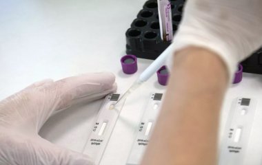 Епідеміолог пояснила різницю між антитілами М і G до коронавірусу