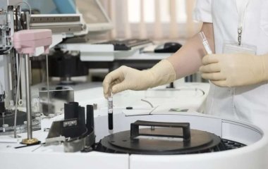 Ученые нашли способ уничтожить раковые клетки с помощью сахара