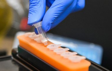 Що потрібно зробити перед щепленням від коронавірусу