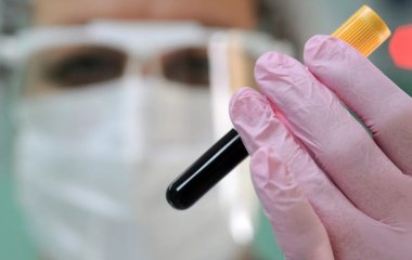 Названі продукти, які слід вживати при постковидном синдромі