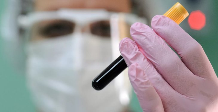 Названі продукти, які слід вживати при постковидном синдромі