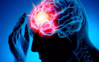 Високий рівень холестерину визнали фактором, що підвищує ризик розвитку інсульту.