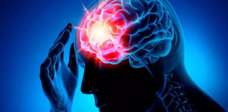 Высокий уровень холестерина признали повышающим риск развития инсульта фактором