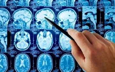 Вчені назвали дитячі інфекції причиною склерозу у старшому віці