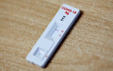 Сам собі діагност. Які тести з аптеки можна використовувати вдома