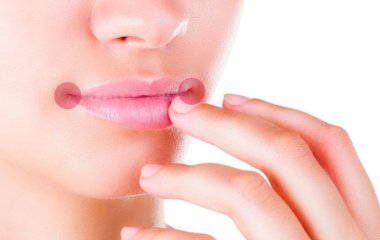 Як позбутися заїдів у куточках рота