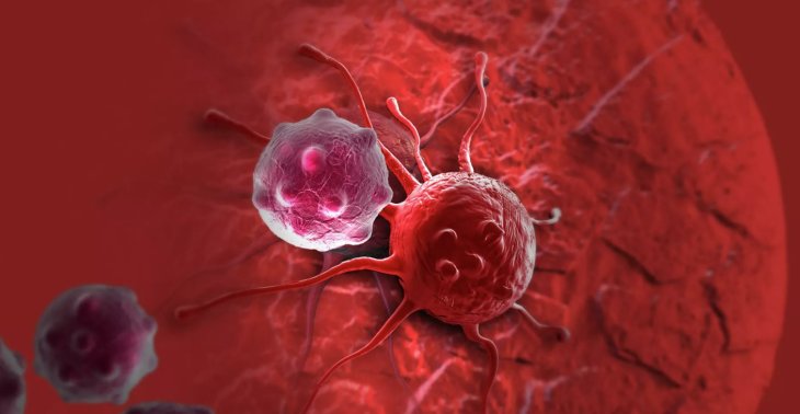 Невролог заявил о связи между подергиванием глаза и раком