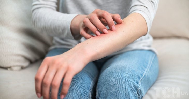 Шкіра злазить шматками: у людей з’явилось загадкове захворювання, яке не знають як лікувати