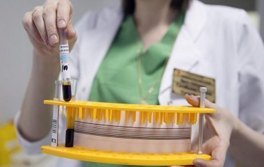 Онколог назвала 12 основних симптомів раку