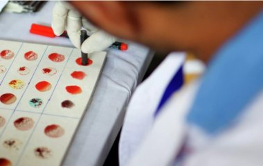 Резус-фактор: що таке та навіщо його визначати майбутнім батькам