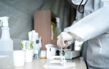 Інфекціоніст назвав перші симптоми конго-кримської лихоманки