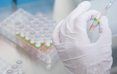 Вірусолог заявив про безпеку «стелс-Омікрона» для «Омікроном», які перехворіли