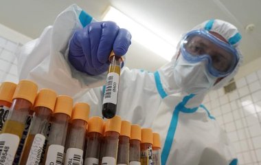 Вчений розповів про властивості препарату COVID-19 на основі антитіл