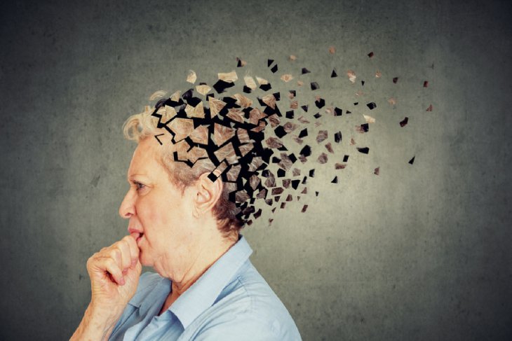 Медики назвали ранний симптом болезни Альцгеймера