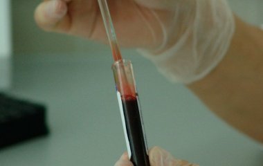 Лікар назвала ознаку раку, що зустрічається у чоловіків