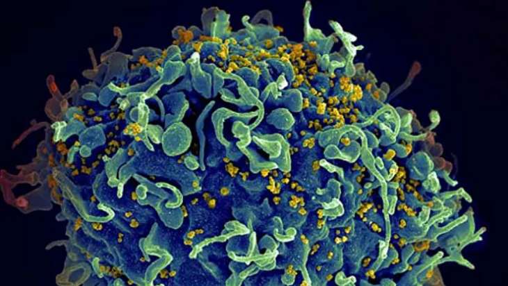 Генетики раскрыли ранее неизвестную опасность ВИЧ-инфекции
